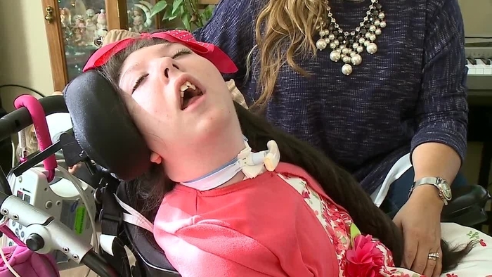 스무번째 생일을 맞은 미국의 물무뇌증 환자 알렉스 심슨(20). 사진=Lorena Simpson/KETV 캡처